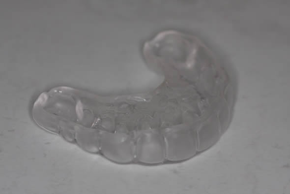 Mouthguard At Durrheim And Associates Dental Clinic In Marlborough NZ