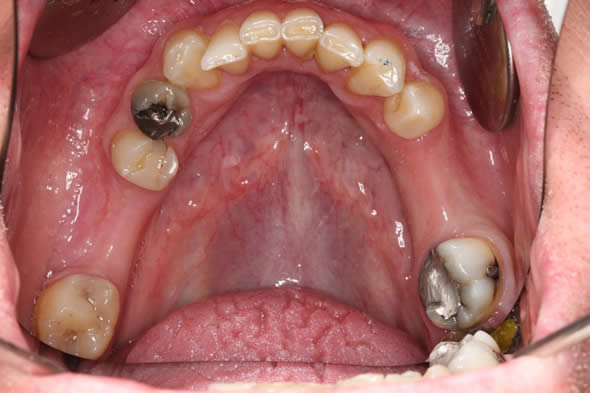Oral Examination At Durrheim And Associates Dental Clinic In Marlborough NZ